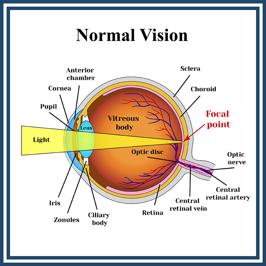 normal-vision